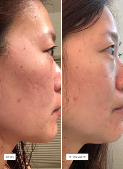 Glass Skin Refining Serum 40ml