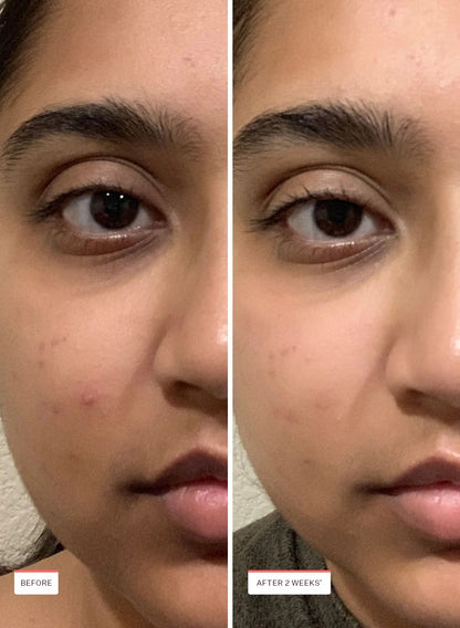 Glass Skin Refining Serum 40ml